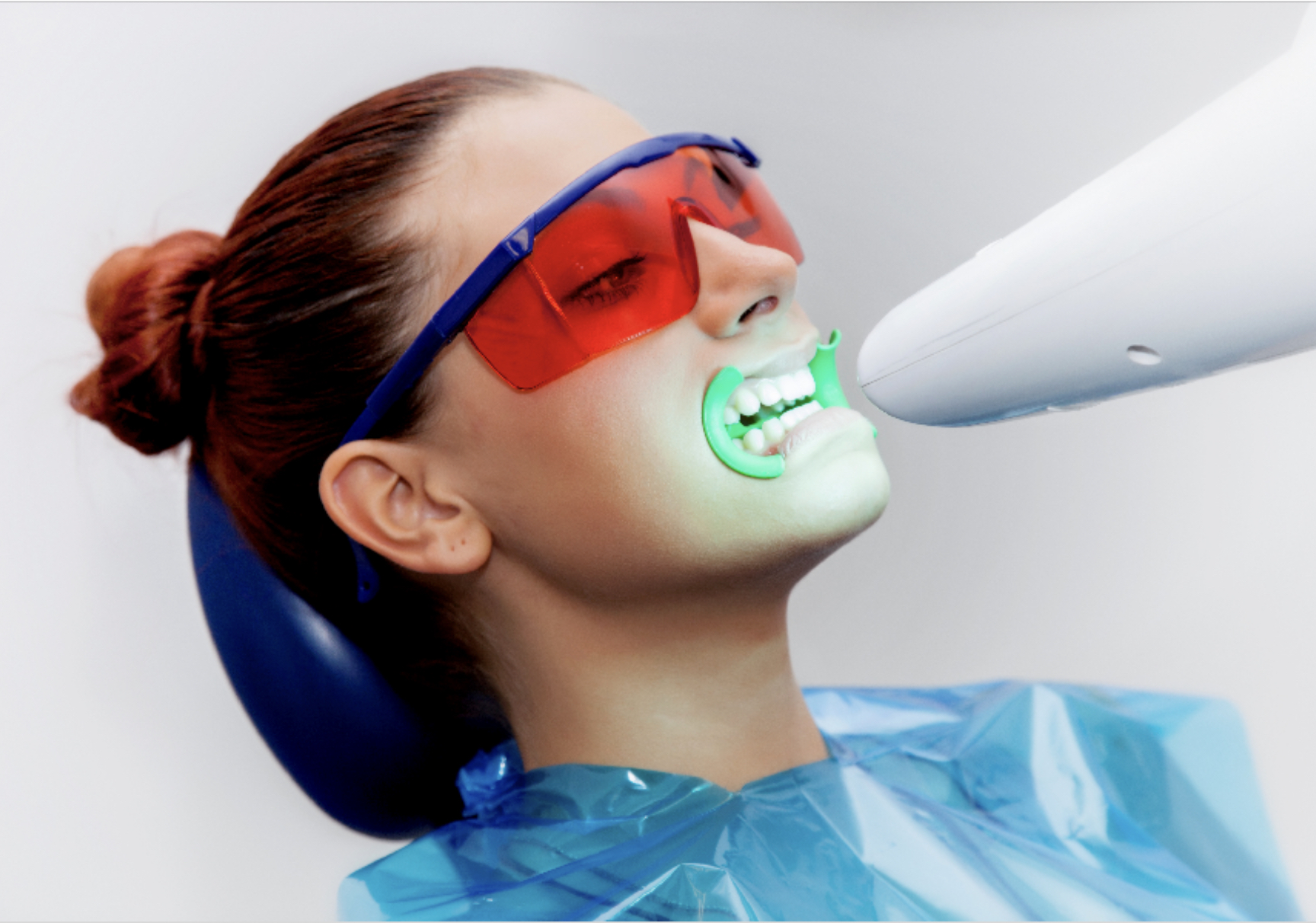 sbiancamento denti lampada led 1 1